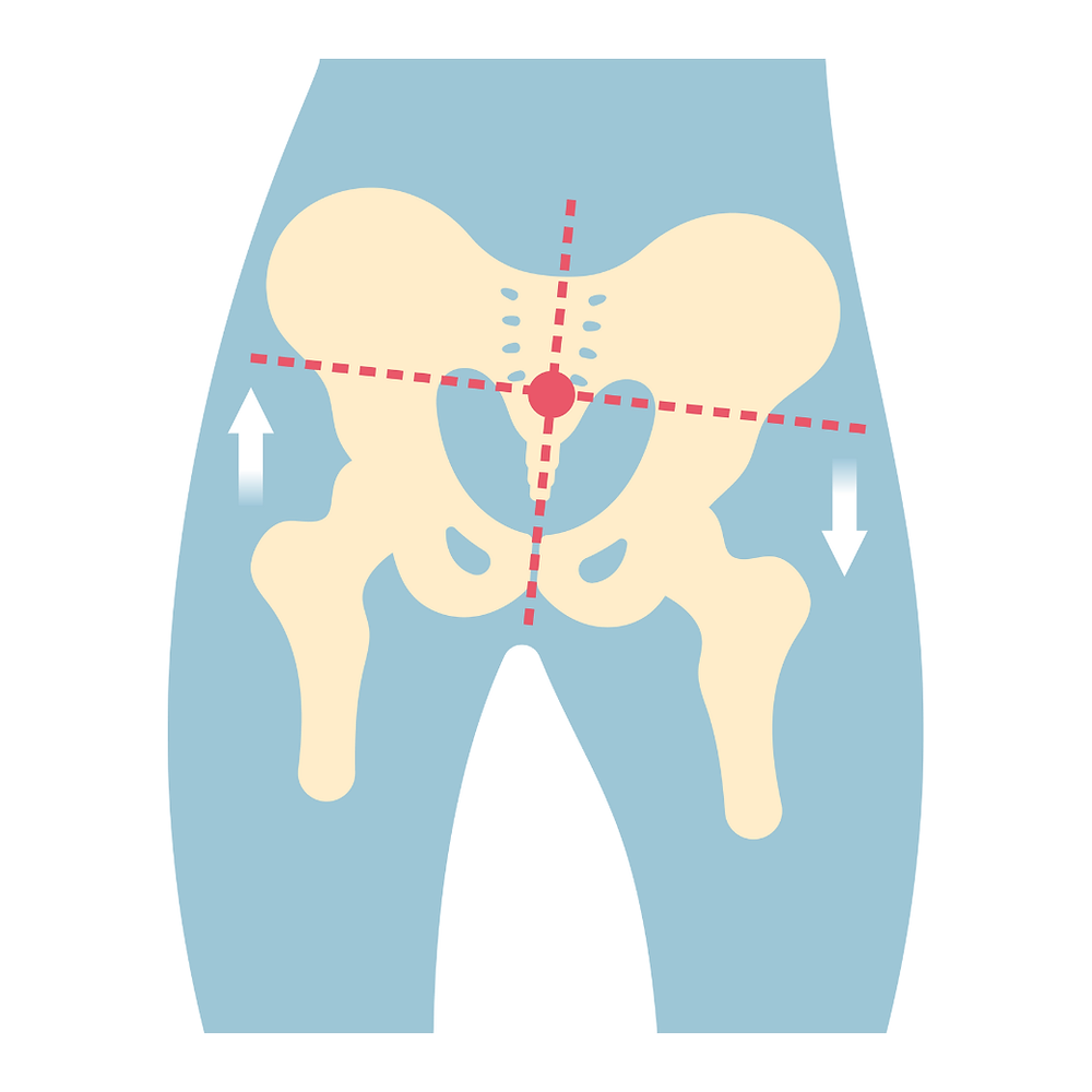 Pin Alignment Hip Hip Alignment Chiropractor Sanford FL | Journey Spinal Care