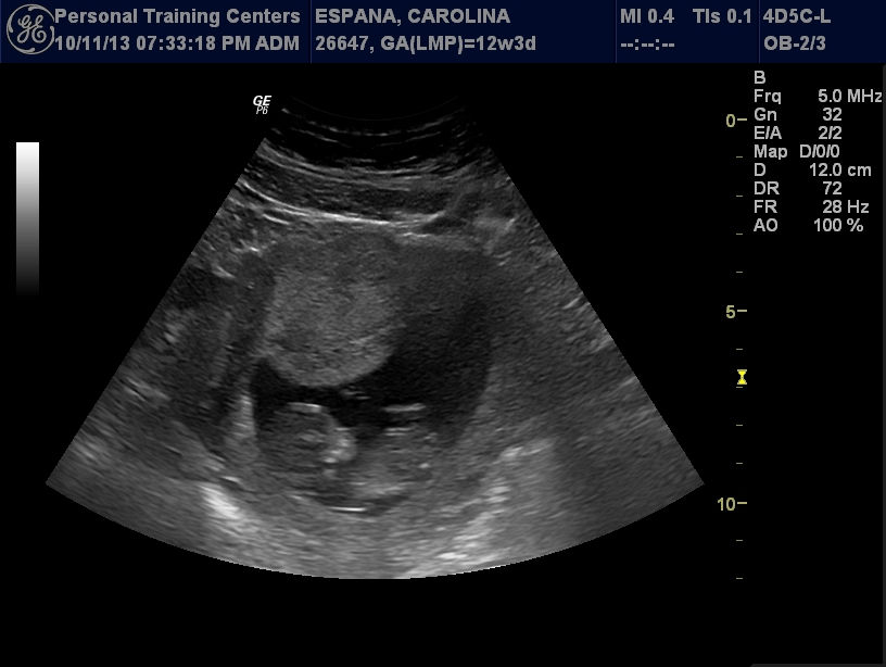 Embarazo y Parto.....Cambios Hormonales....