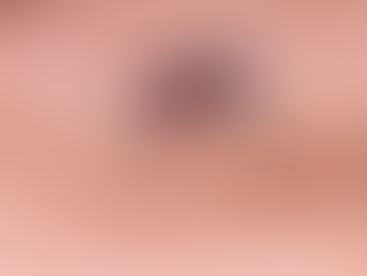 El mosquito que preocupa a las autoridades en Chile: ¿Qué es el Dengue, cómo cuidarse y por qué importa ahora?