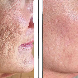 Before And After Texture Change