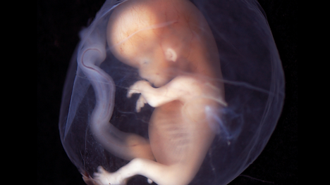 EMBRYO.png