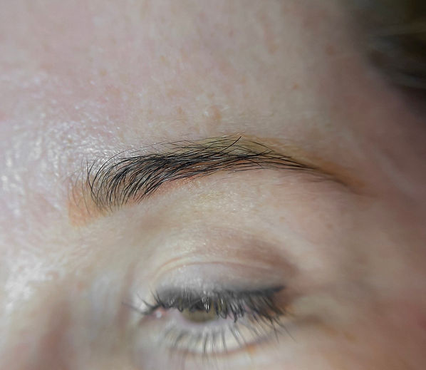tattoo-removal-hawaii-6.jpg