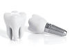 implante-clinica-dental-lopez-valdes.jpg