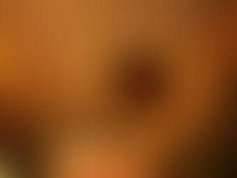 Shirodhara: An Ancient Ayurvedic Therapy for Holistic Wellness