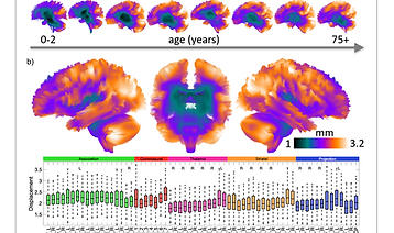 Inter-individual differences in brain anatomy are often treated as noise, yet may encode meaningful principles of organisation. Using >2,800 diffusion MRI scans spanning 0–100 years, we quanti ed spatial, microstructural and macrostructural variability across 64 major white-matter pathways. Variability is not random: spatial organisation follows a deep-to-super cial gradient, and variability across individuals shows a convergence–divergence pro le, decreasing in early development and increasing in ageing. Microstructural and macrostructural features exhibit distinct trajectories and hemispheric asymmetries. Importantly, tract variability relates to individual differences in behaviour, most strongly during development. These results rede ne white-matter variability as a structured, developmentally dynamic, lifespan-dependent feature of brain organisation and provide a foundation for normative modelling and precision neuroscience.
