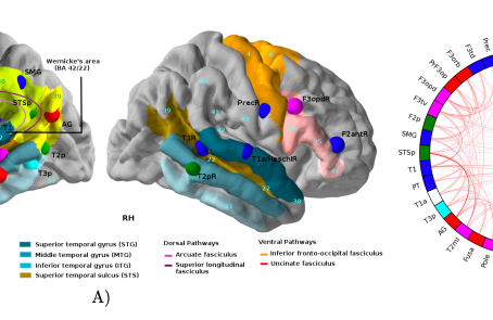 Preprint: The genetic architecture of language functional connectivity