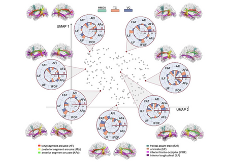 Rethinking language lateralisation