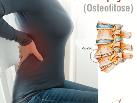 Bico de Papagaio (Osteofitose)