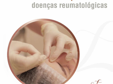 Acupuntura nas doenças reumatológicas