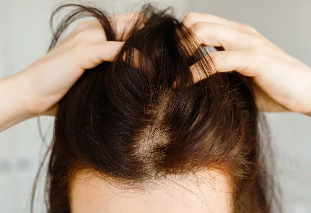 girl hair itchy head sores skin