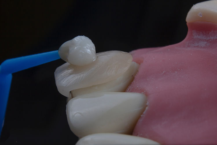 Image by Ozkan Guner