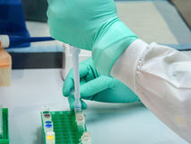 Biogen announces positive results for Alzheimer's drug Lecanemab