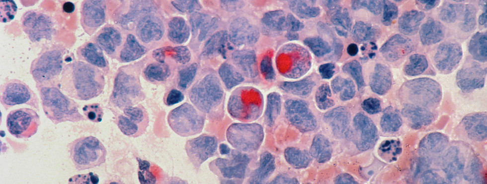 Image by National Cancer Institute