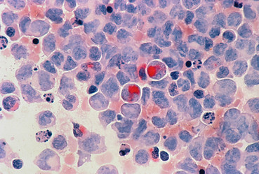 Image by National Cancer Institute