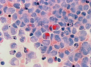 Image by National Cancer Institute