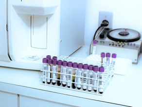 TRT Done Right: Why One Testosterone Number Doesn't Tell the Whole Story