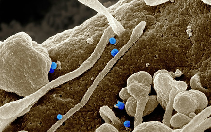Image by National Institute of Allergy and Infectious Diseases