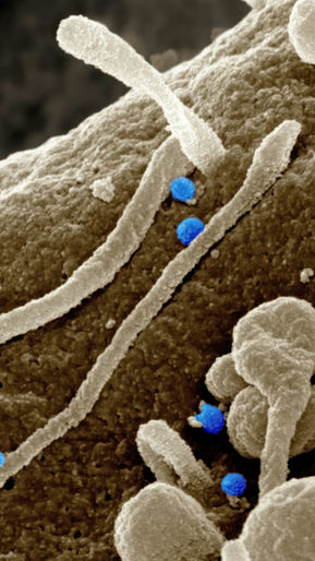 Como as bactérias intestinais moldam a energia, os desejos e o peso