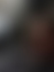 Сроки и выздоровление