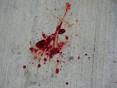 Sleeping On Your Period: How To Avoid Leaks