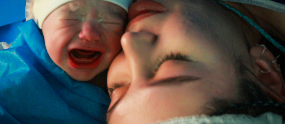 Supporting Clients Through Caesarean Birth With Compassion