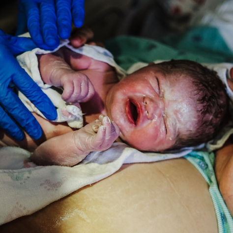 C-Section Births and Bazi Destiny