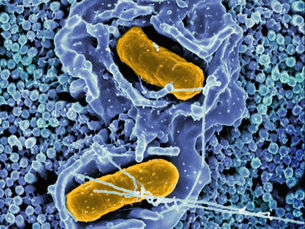 Cómo el estrés crónico altera la microbiota y potencia los síntomas digestivos