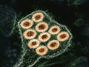 Hemifused Vesicles and Their Role in Cellular Transport