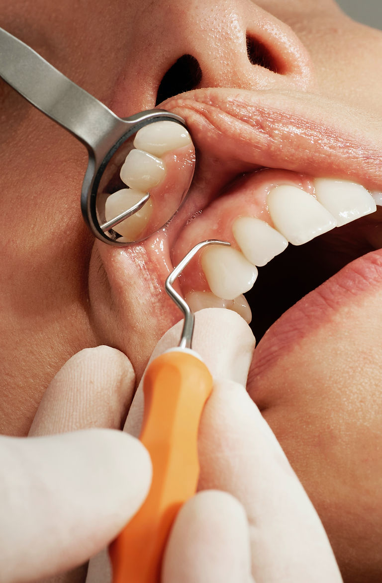 dental cleaning dentist in Warren, NJ