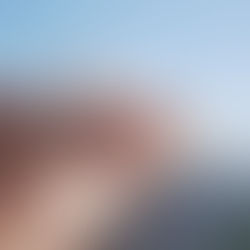 Bee venom cream applied to skin