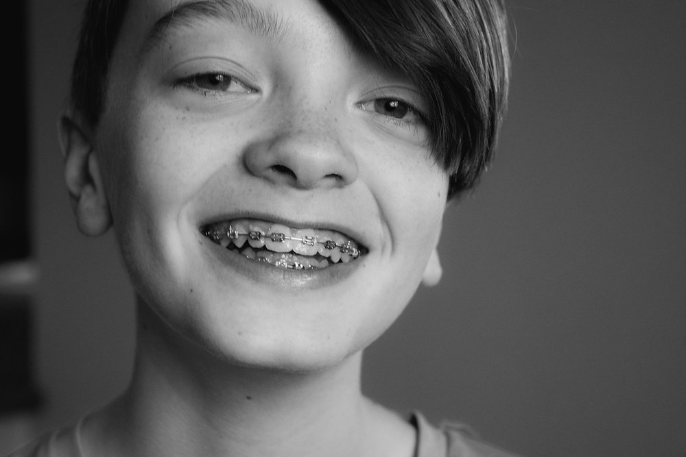 Can You Drink Soda With Braces Or Should You 1311 Jackson Ave Dental can-you-drink-soda-with-braces-or-should-you-1311-jackson-ave-dental