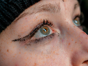 Close-up of a human eye showing subtle eyelid heaviness and irritation, illustrating early symptoms of Thyroid Eye Disease (TED) that can cause heavy eyes even after rest. | South Bay Retina, San Jose, Gilroy  