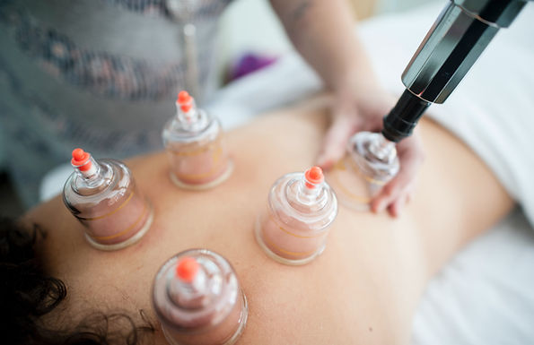 Cupping Session