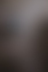 Responsabilité du fait des choses : quels recours en cas de chute, d’objet tombé ou d’équipement défectueux ?