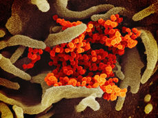 WHO Approves First Rapid Diagnostic Test for Bundibugyo Ebola Virus