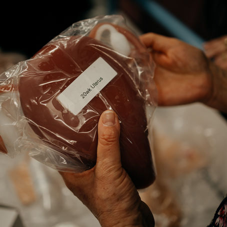 La greffe d’utérus