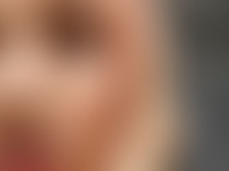 Woman with cortisol face