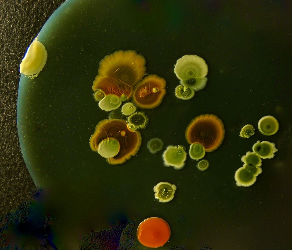 petri dish