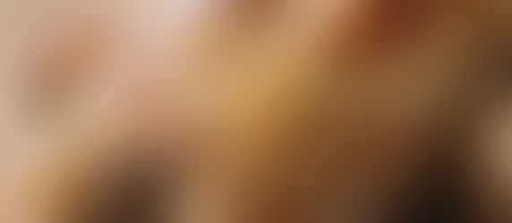 You Can Eat Very Healthy - But It May Not Be the Right Diet for You: How Histamine Intolerance & Mast Cell Activation Play a Role