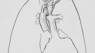 POTS: Wenn Aufstehen zum Problem wird – Ursachen, Symptome, Diagnose & moderne Therapie (inkl. Physiotherapie)