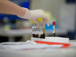 A gloved laboratory technician handling blood sample tubes for fatigue blood tests