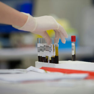 blood tests