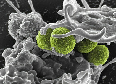 Image by National Institute of Allergy and Infectious Diseases