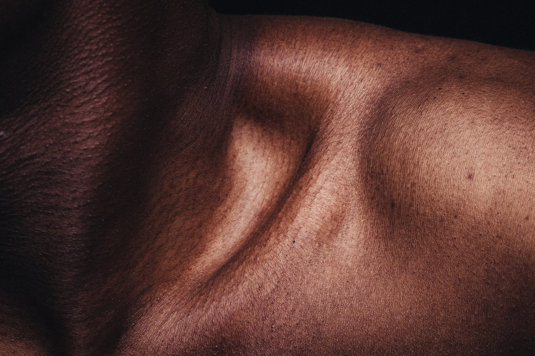 10-fold increase in the number of people with uncomfortable skin condition