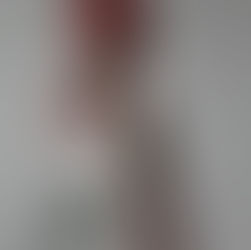 A Rose by Any Other Name - Has a Ton of Skin Benefits!