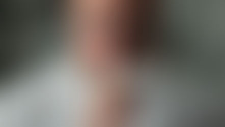 Información fundamental acerca de las alergias