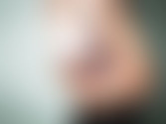 Pedra na Vesícula e Seus Sintomas