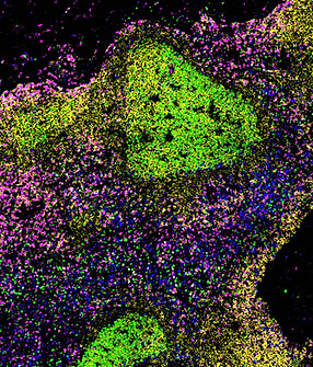 Image by National Institute of Allergy and Infectious Diseases