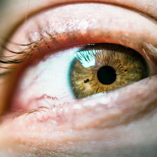 Conjuntivitis
