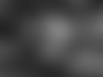 Does Dermaplaning Make Hair Grow Back Thicker?